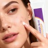 Azelaic Acid Cream, Serum With Azelaic Acid Al