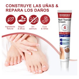 Crema Fúngica Para Uñas,eliminación Hongo De La Uña 20g
