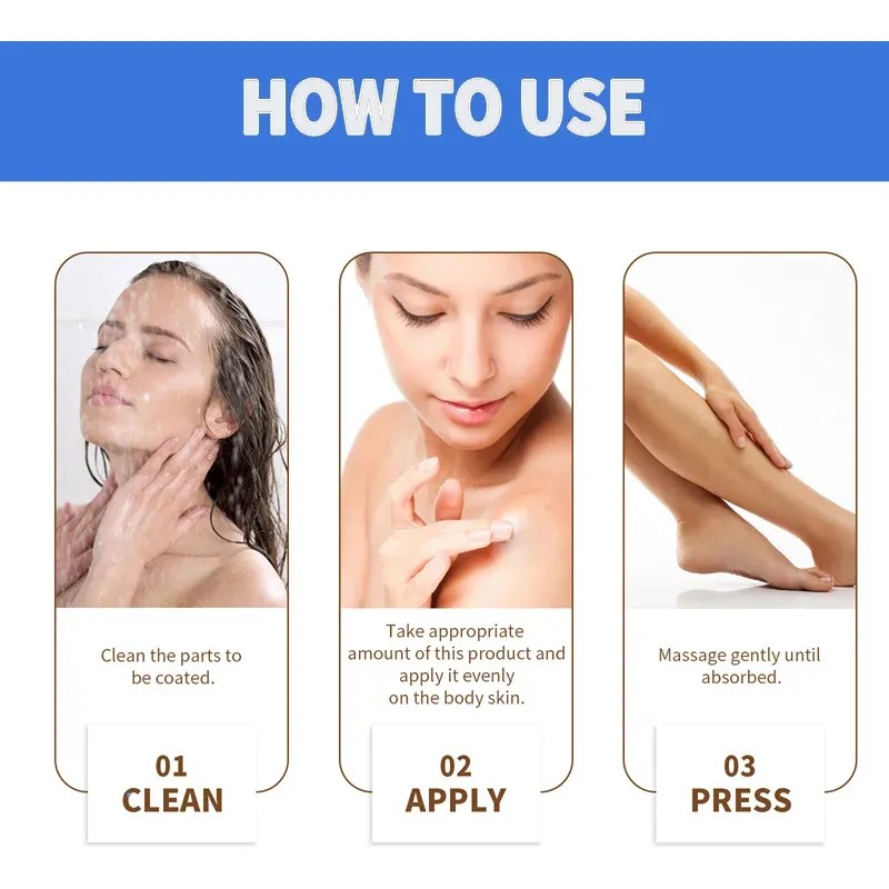 Crema Blanqueadora Para Tratar La Queratosis Corporal Con Pr