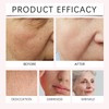 Smoothing Wrinkle Facial Patches