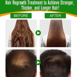 Baorder Batana Oil 60 ml, Batana Oil for Healthy Hair Growth, Batana Oil Organic Cold Press, 100% Natural Batana Hair Oil, Batana Oil for Hair, Eyebrows and Eyelashes, Improves Hair and Skin Shine