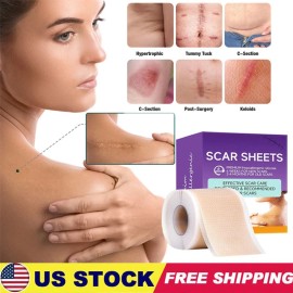 Unbranded Silicone Scar Sheets,(1.6" X 60" Roll-1.5M) Silicone Scar Tape for Surgical Scar