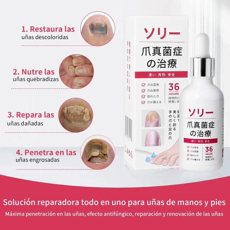 Líquido Para Hongos En Las Uñas Tratamiento Efectivo 50ml