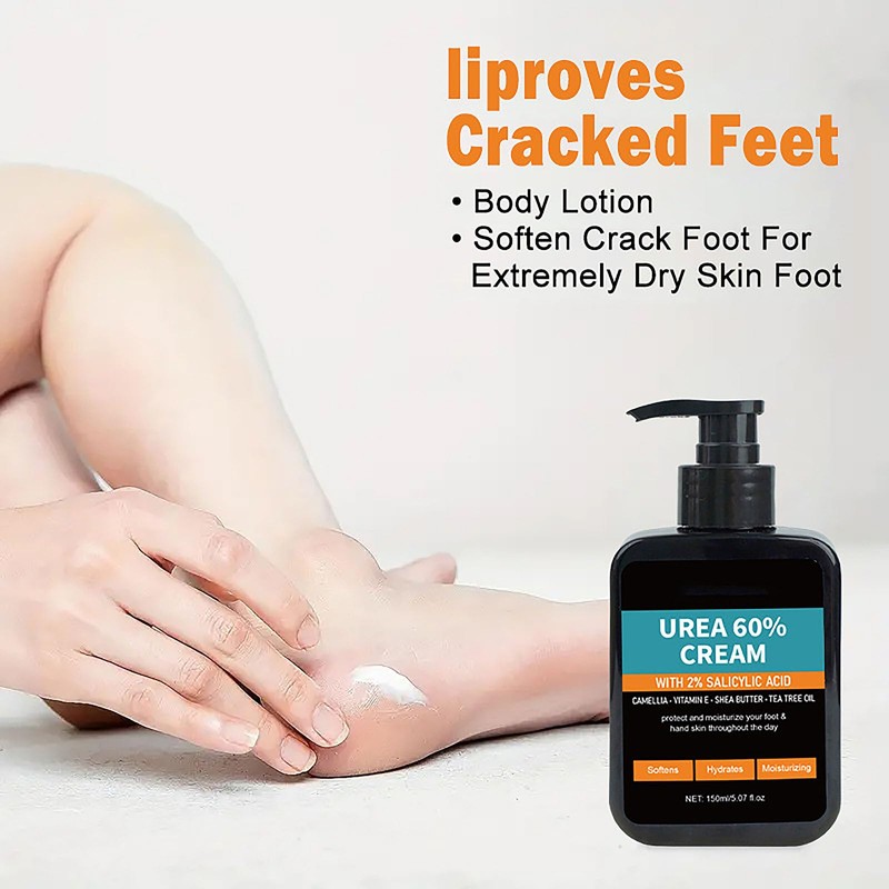 60% Urea Cream with 2% Salicylic Acid, Urea Cream 60