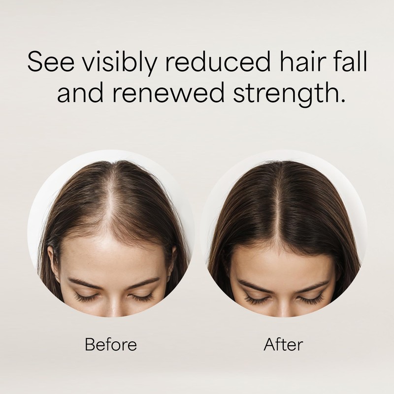 Kismera Hair Loss Shampoo 500ml + Cream 500ml Combo Set
