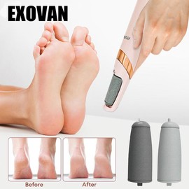 EXOVAN Electric Feet Callus Remover,Portable Electronic Foot File Pedicure Tools,Waterproof Foot Scrubber File,Pedi Foot Care for Dead,Hard Cracked Dry Skin Manicure Nail Nail Care Cutics Nail Art