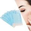 Face Lifting, Collagen Silk Threads, Collagen Silk Threads for Lifting,