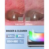 Anykit Digital Otoscope with Gyroscope, 4.5 Inches Screen, 3.9mm Ear