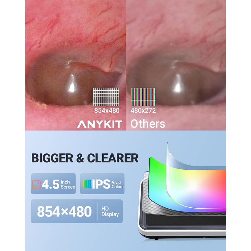 Anykit Digital Otoscope with Gyroscope, 4.5 Inches Screen, 3.9mm Ear