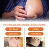 20g Skin Care Cream, Can Relieve Redness, Itching, Relieve and