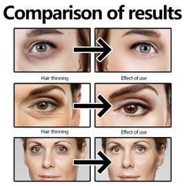 Vitamin C Eye Cream Stick,Under Eye Cream for Dark Circles and Puffy Eyes,Glow Eye Balm,Anti Aging Eye Cream,Cooling & Hydrating Eye Cream for Eye Bags Remover,Firming Eye Stick for All Skin Types