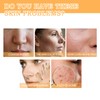 100 ml Glycolic Acid Toner, Glycolic Acid Peeling 7% Ige