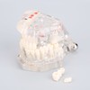 Detachable Dental Model Dental Disease Teaching Study Typodont Demonstration Tooth