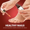 Abera Maximum Strength Nail Repair Serum - Intensive Care for