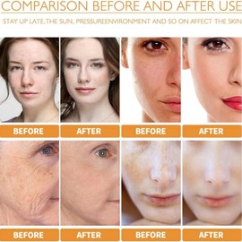 Kojic Acid Soap,Turmeric Brightening Soap,Turmeric Soap Bar,Turmeric Kojic Acid Dark Spot Remover Soap Bars,Kojic Acid Soap for Face and Body,Kojic Acid & Turmeric Soap,Face Soap Bar for Men and Women