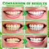 Spearmint Oil Pulling Rinse, Cold-Pressed Coconut Oil for Teeth, Mint