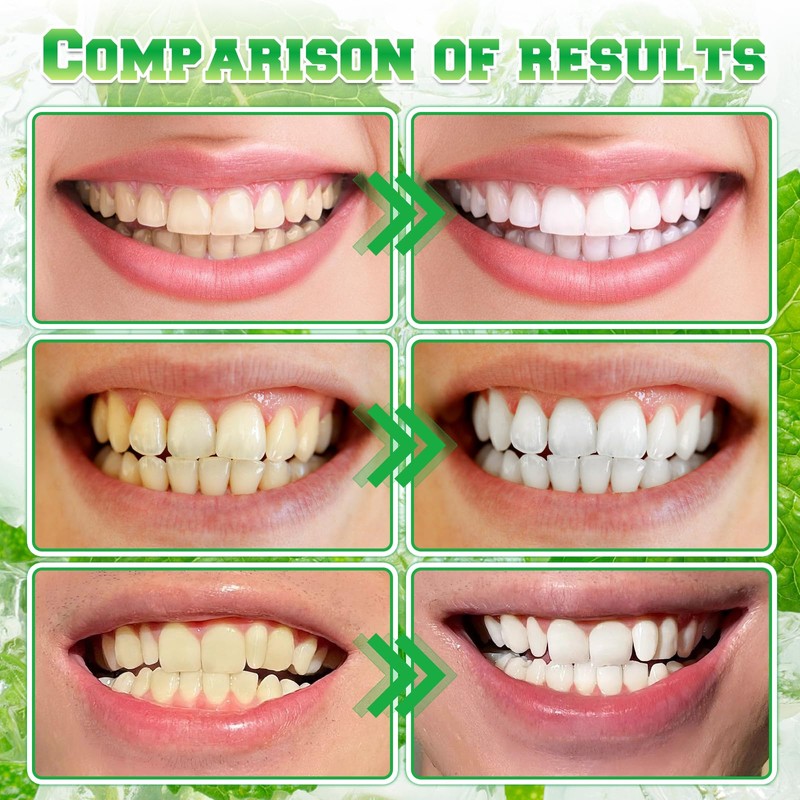 Spearmint Oil Pulling Rinse, Cold-Pressed Coconut Oil for Teeth, Mint