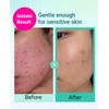 BRING GREEN TEA TREE CICA TRIAL KIT | Travel Size