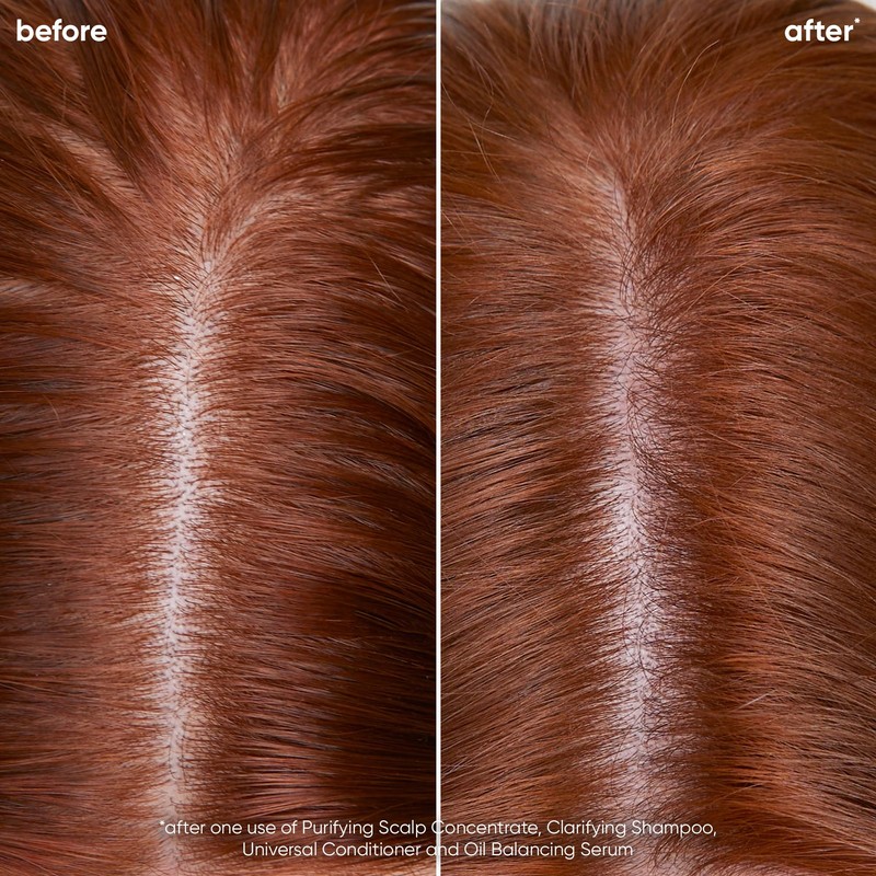 Biolage Scalp Sync Clarifying Shampoo | Removes Residue, Buildup &