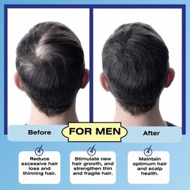 Numinox - Mediceuticals Folicle Revitalizer 8.45 oz (8.5 fl oz) Bloqueador DHT para hombres - Bloqueador de DHT para mujeres - Pérdida repentina de cabello - efluvio telógeno - Estimulador de folículo