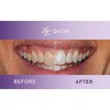 Snow The Magic Strips - Safe for Enamel Dissolving Teeth