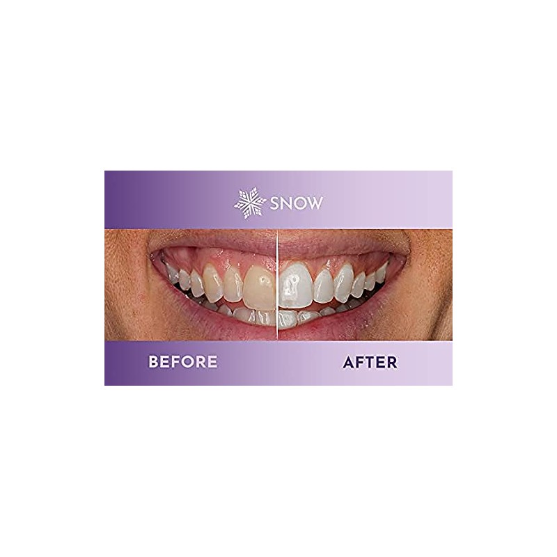 Snow The Magic Strips - Safe for Enamel Dissolving Teeth