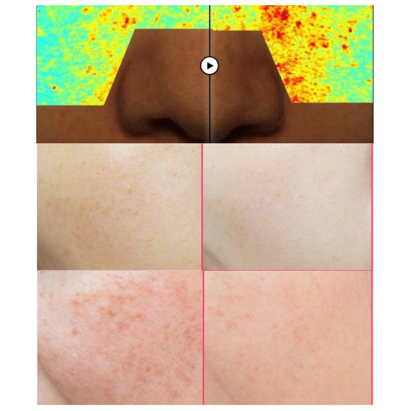 RE:DENSE Tone & Spot Corrector Ampoule 30ml