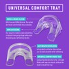 iSmile Teeth Whitening Kit - LED Light, 35% Carbamide Peroxide,