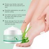Urea Foot Cream, Urea Cream 40 Percent for Feet and