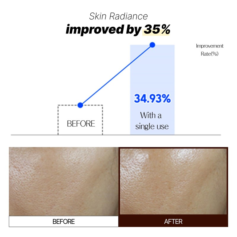 Labiora Glow Aurora Serum – Niacinamide Face Serum with Hyaluronic