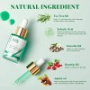 Aceite Facial Acne Anai Rui De Arbol De Te Acido