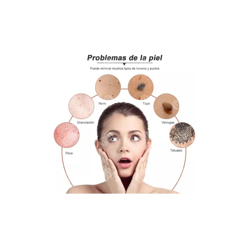 Eliminador Laser Plasma De Verrugas Genitales Vph Acne Full