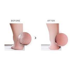 nu119 120ml Platinum Instant Foot Peeling Spray – Professional Callus & Corn Remover – Fast-Acting Exfoliating Foot Peel for Cracked, Dry, Rough Skin – Includes Durable Luxury Foot File