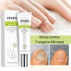1pzs Crema Natural Hongos Uñas Pies Efero Gel Reparador 20ml