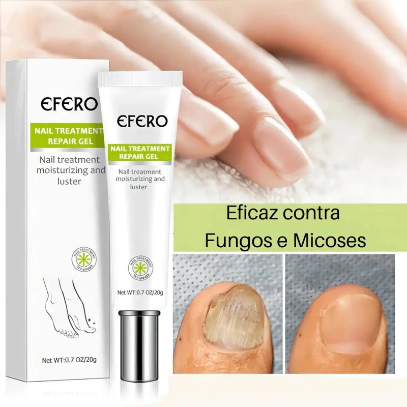 1pzs Crema Natural Hongos Uñas Pies Efero Gel Reparador 20ml