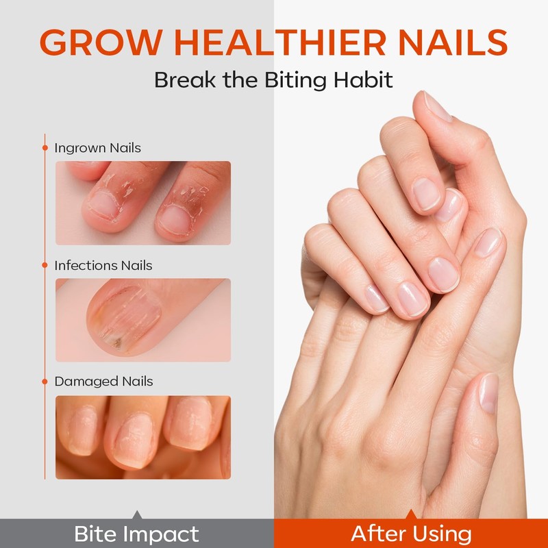 modelones Modelones Nail Biting Treatment, No Bite Nail Polish, Thumb
