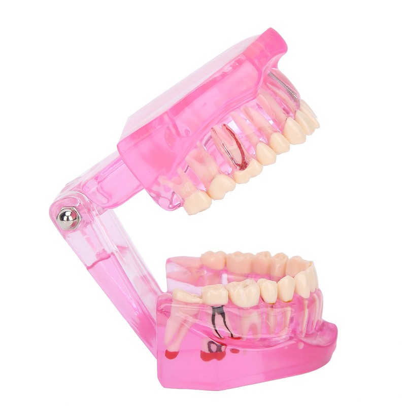 Transparent Adult Teeth Model Pathological Repair Studying Dental Teaching Tools