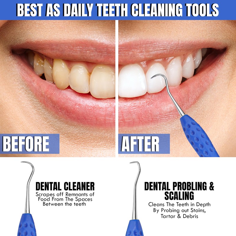 Professional Dental Tools Tartar Scraper for Dentist, Personal Use and