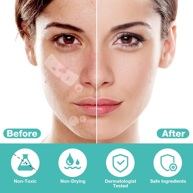 BUTBU 265 Stücks Pickel Patch Groß, 4 Größen Pimple Patches