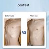 Broken Rib Belt Fixation Detachable Breathable Comfortable Reduce Soreness Elastic