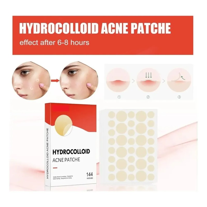 Set De 144 Parches Faciales Hidrocoloides Espinillas Antiacn Todo Tipo