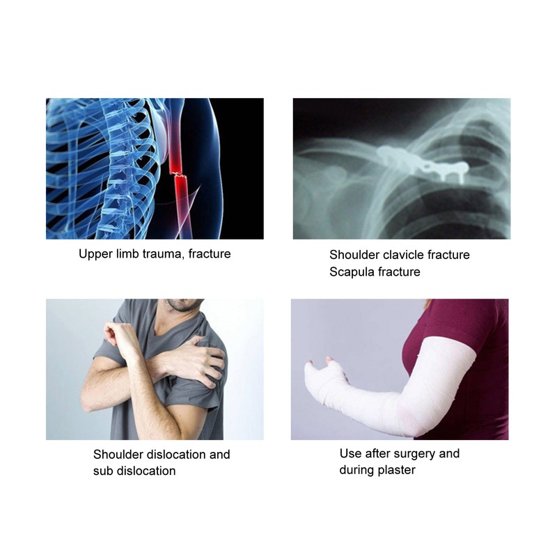 Ober Arm Sling Comfortable Adjustable Shoulder Immobilizer with Waist Strap