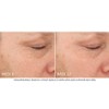 NEOSTRATA Skin Active Tri-Therapy Lifting Serum 30mL