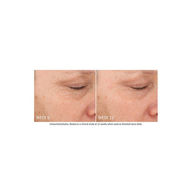 NEOSTRATA Skin Active Tri-Therapy Lifting Serum 30mL