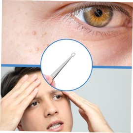 FOMIYES 1pc Stainless Steel Blackhead Tool Pimple Remover Tweezers Compact Design for Safe Skin Care and Treatment