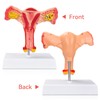 SimCoach Human Uterus and Ovary Anatomical Model, Female Reproductive Model