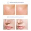 Laikou Pro Moisturizing Essence Repair Skin Shrink Pore 2pcs