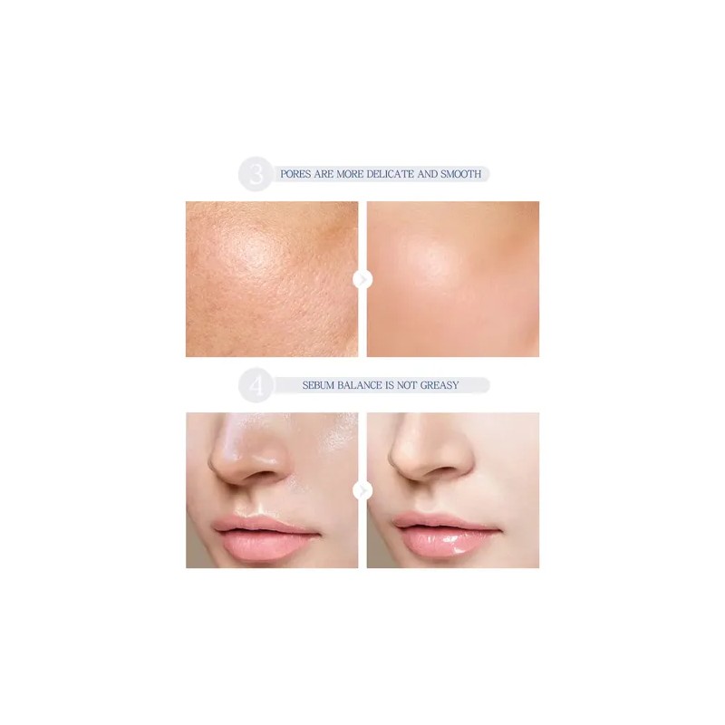 Laikou Pro Moisturizing Essence Repair Skin Shrink Pore 2pcs
