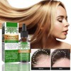 Aceite Natural de Romero para Crecimiento del Cabello