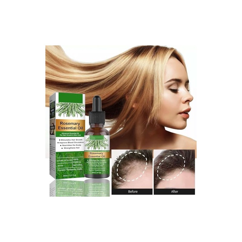 Aceite Natural de Romero para Crecimiento del Cabello